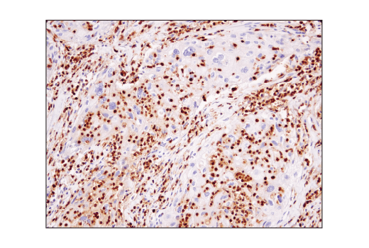  Image 12: Suppressive Myeloid Cell Phenotyping IHC Antibody Sampler Kit