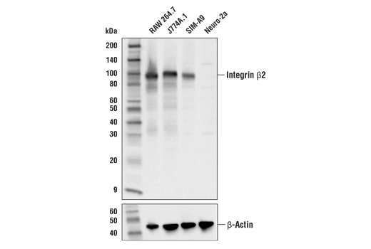 Western Blotting Image 1: Integrin β2 Antibody