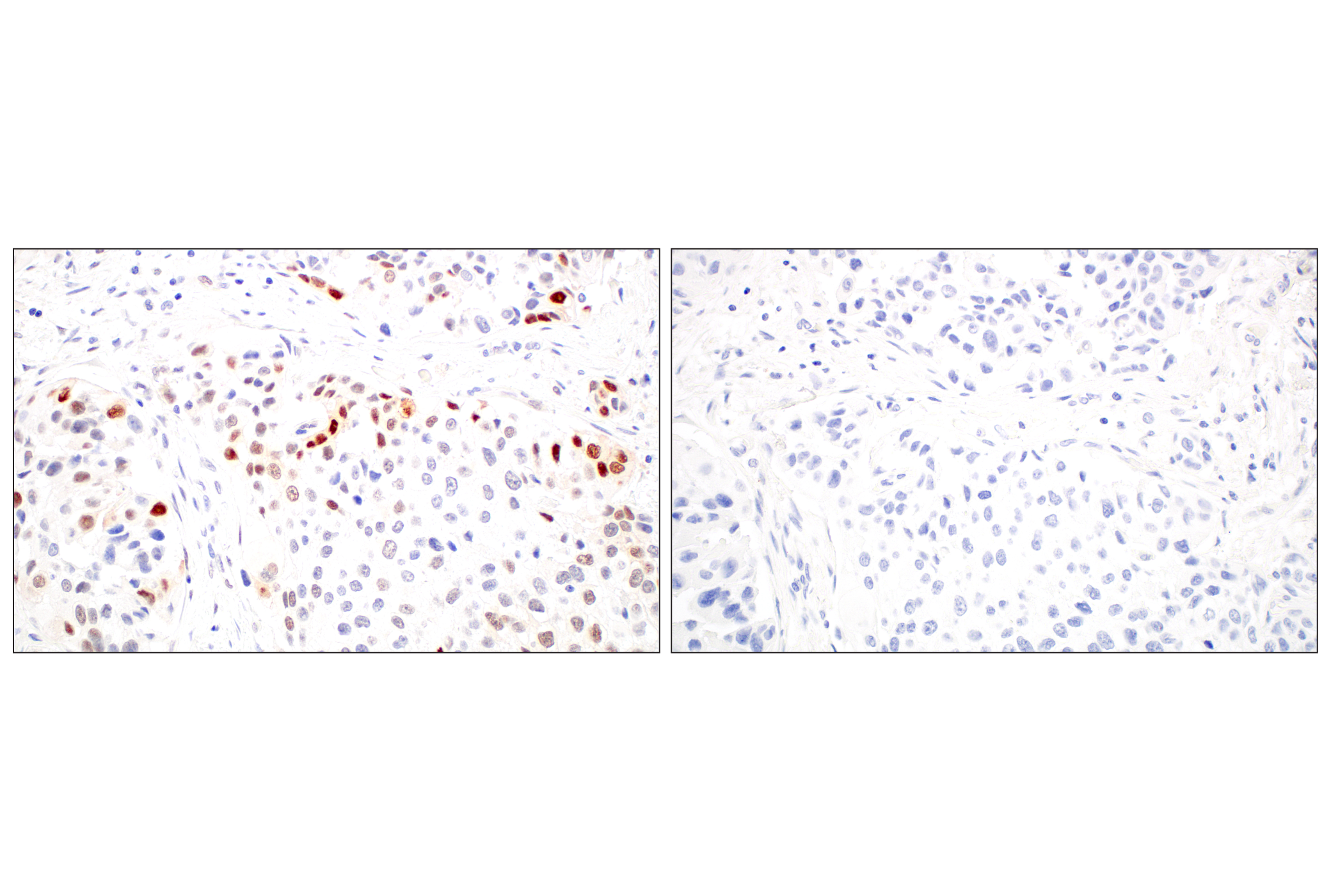 ARK5 (E4T2A) Rabbit MAb | Cell Signaling Technology