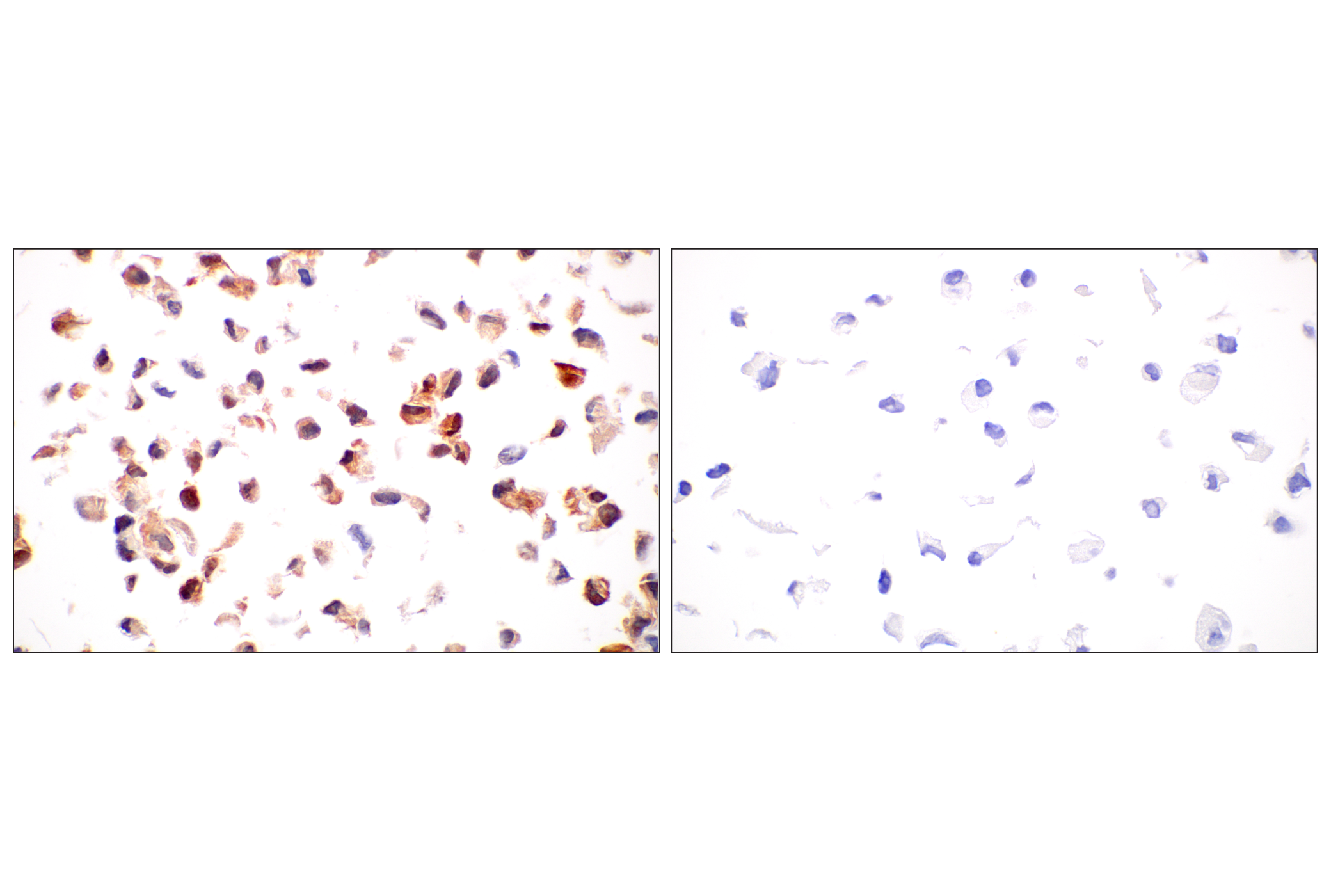 ARK5 (E4T2A) Rabbit mAb | Cell Signaling Technology