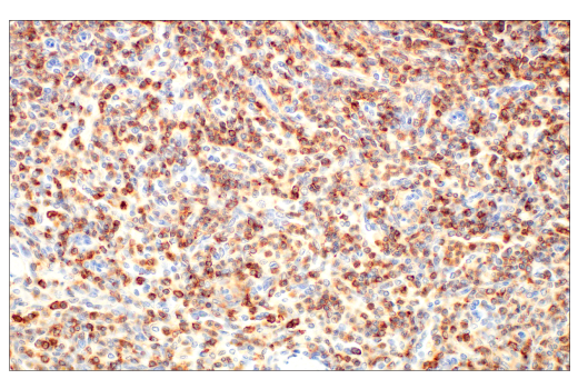 Immunohistochemistry Image 3: CD45 (Intracellular Domain) (D9M8I) XP® Rabbit mAb (BSA and Azide Free)
