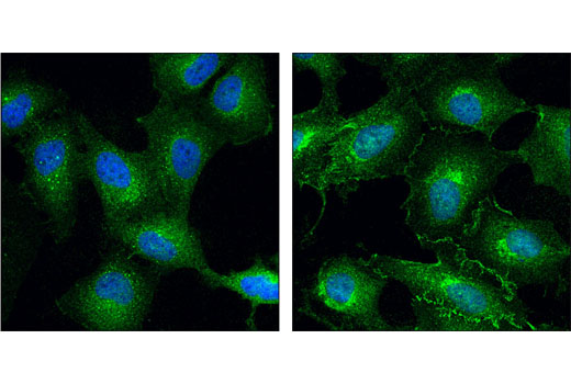 Immunofluorescence Image 1: CDC37 (D11A3) XP® Rabbit mAb