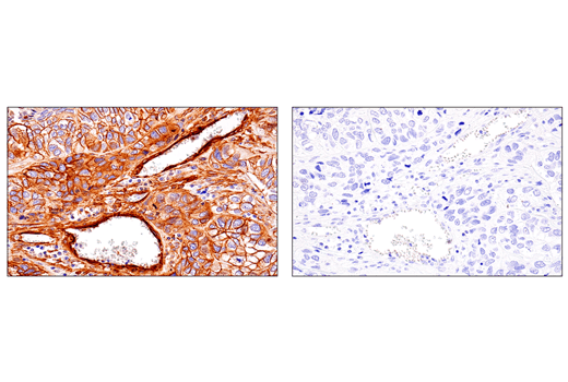 Immunohistochemistry Image 3: CD248 (E9Z7O) XP® Rabbit mAb