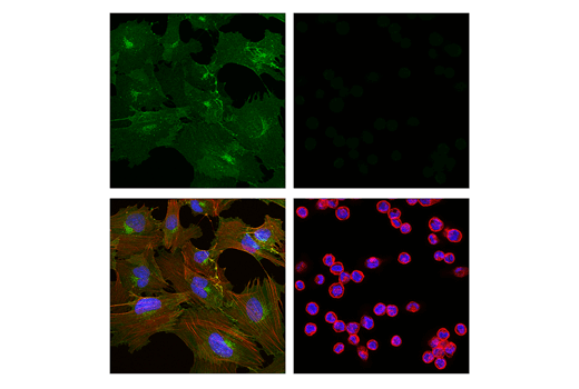 Immunofluorescence Image 1: CD248 (E9Z7O) XP® Rabbit mAb