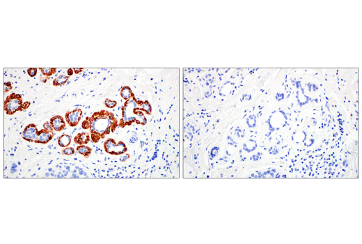 Immunohistochemistry Image 2: Keratin 14 (LL002) Mouse mAb