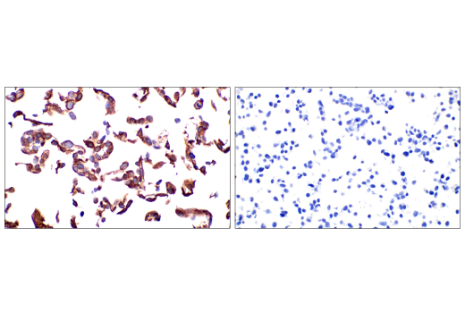 Immunohistochemistry Image 3: Keratin 14 (LL002) Mouse mAb