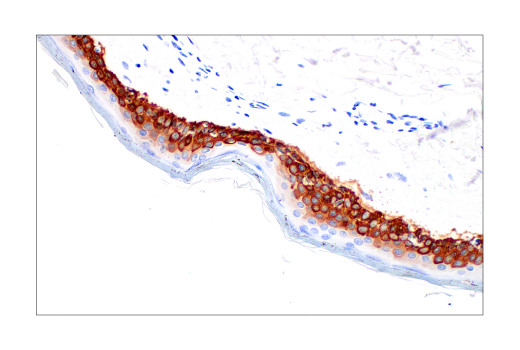 Immunohistochemistry Image 5: Keratin 14 (LL002) Mouse mAb
