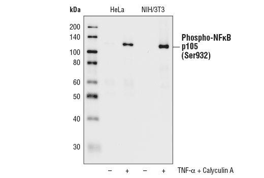 Western Blotting Image 2: Phospho-NF-κB p105 (Ser932) (18E6) Rabbit mAb