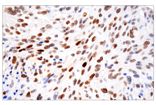 Image 26: Hypoxia Activation IHC Antibody Sampler Kit