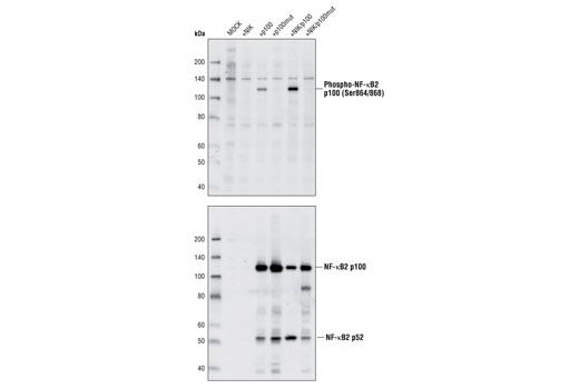 Western Blotting Image 1: Phospho-NF-κB2 p100 (Ser866/870) Antibody