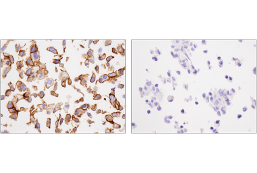 Immunohistochemistry Image 2: Cadherin-6 (D3T3I) Rabbit mAb