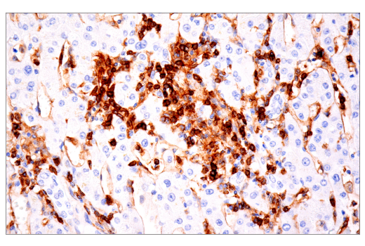 Immunohistochemistry Image 4: CD4 (EP204) Rabbit mAb