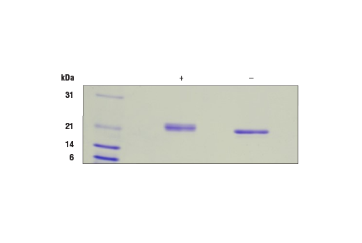  Image 2: Human IL-6 Recombinant Protein