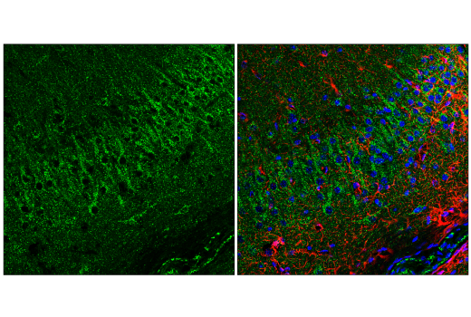 Immunofluorescence Image 2: EEA1 (E9Q6G) Mouse mAb