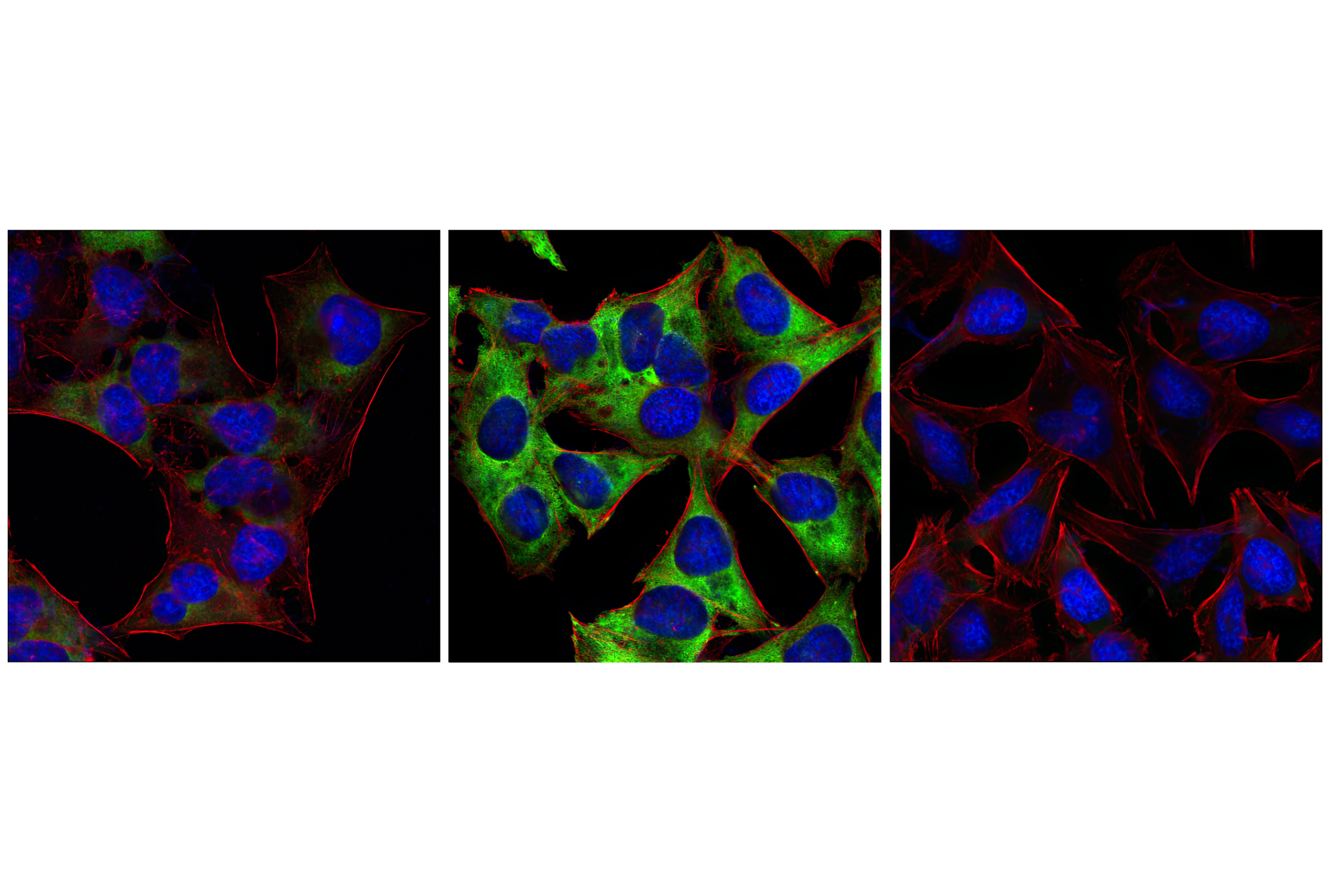 Immunofluorescence Image 1: Phospho-S6 Ribosomal Protein (Ser235/236) (2F9) Rabbit mAb