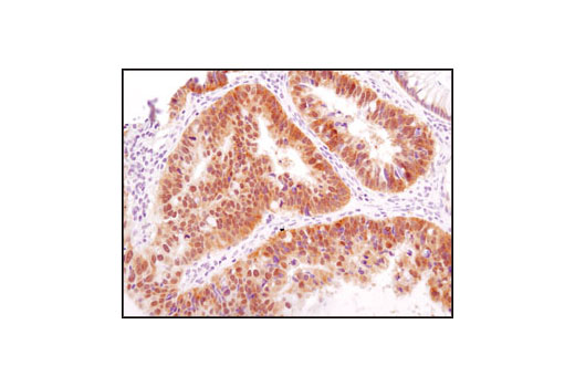  Image 16: HSP/Chaperone Antibody Sampler Kit