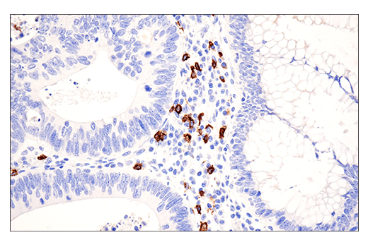 Immunohistochemistry Image 1: CD20 (E7B7T) XP® Rabbit mAb