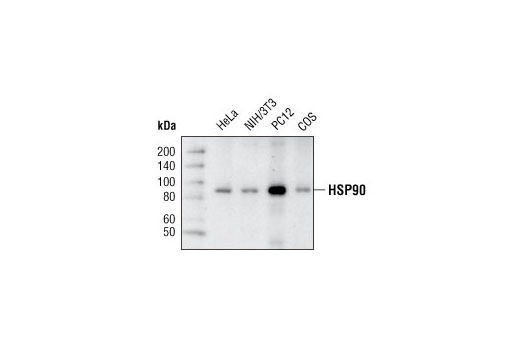  Image 9: HSP/Chaperone Antibody Sampler Kit