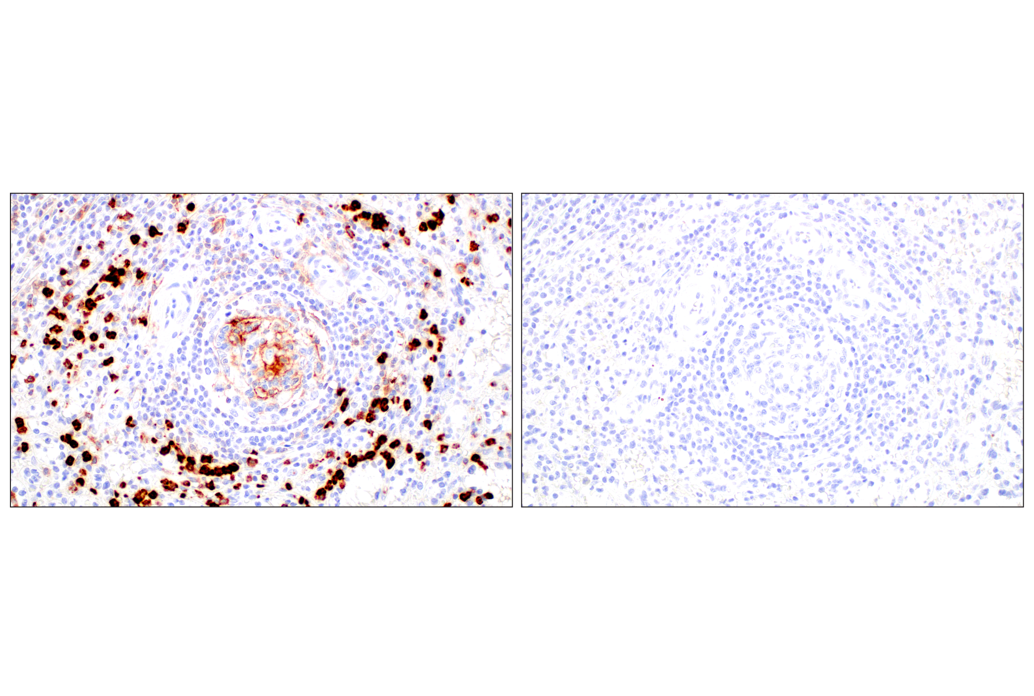 Immunohistochemistry Image 15: CD11b/ITGAM (E3J2F) Rabbit mAb
