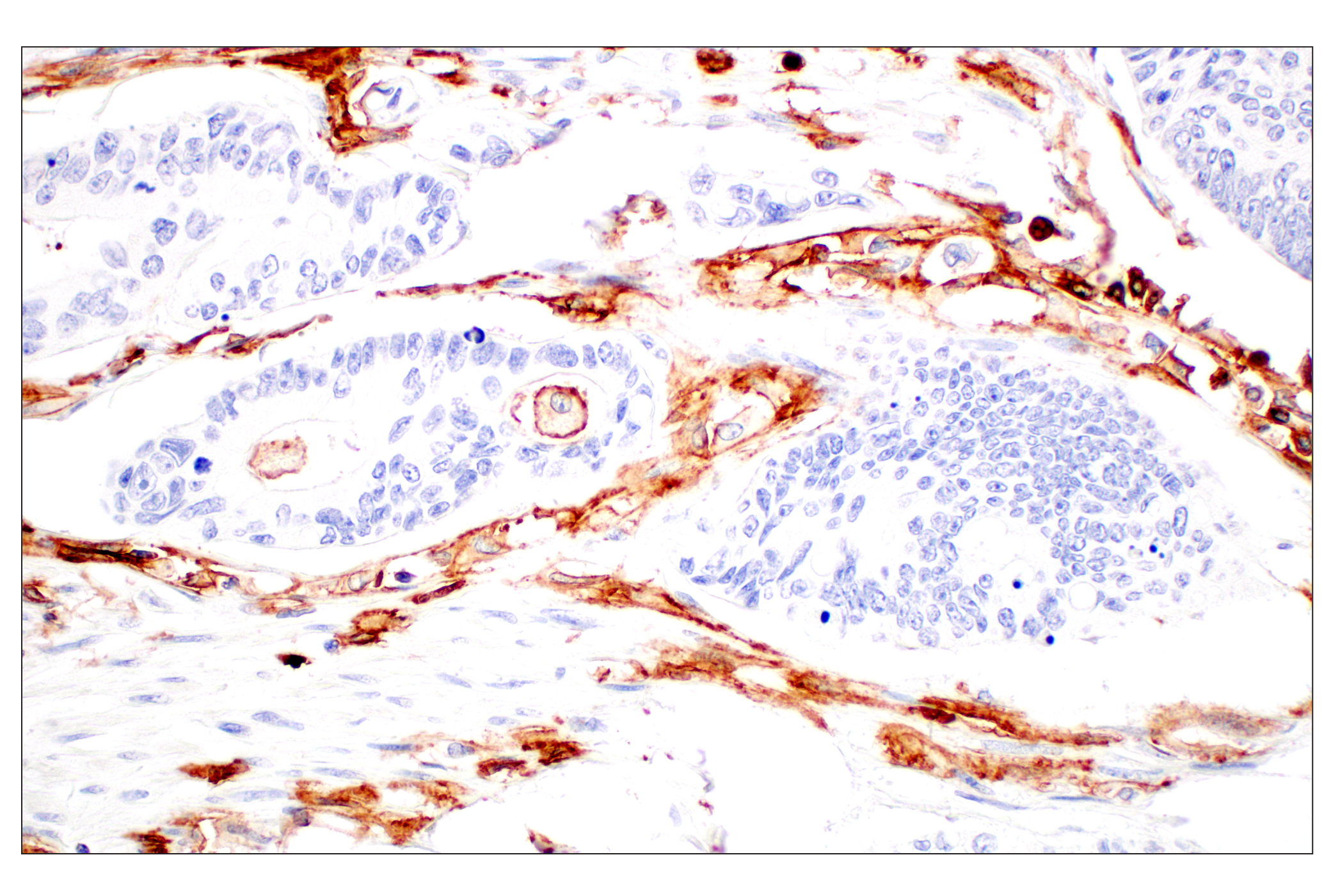 Immunohistochemistry Image 7: CD11b/ITGAM (E3J2F) Rabbit mAb