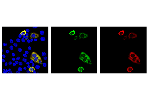 Immunofluorescence Image 1: Cas9 (S. aureus) (6H4) Mouse mAb