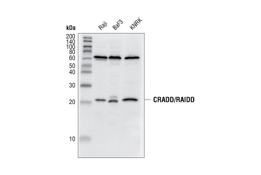 CRADD/RAIDD Antibody | Cell Signaling Technology