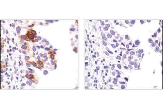 Immunohistochemistry Image 4: Phospho-cdc25C (Ser216) (63F9) Rabbit mAb