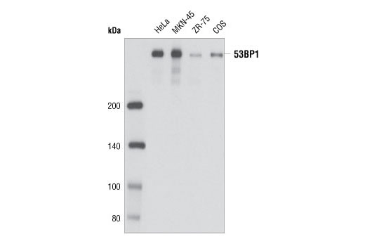 Western Blotting Image 1: 53BP1 (P550) Antibody