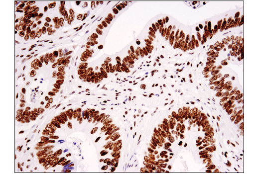  Image 29: Tri-Methyl Histone H3 Antibody Sampler Kit