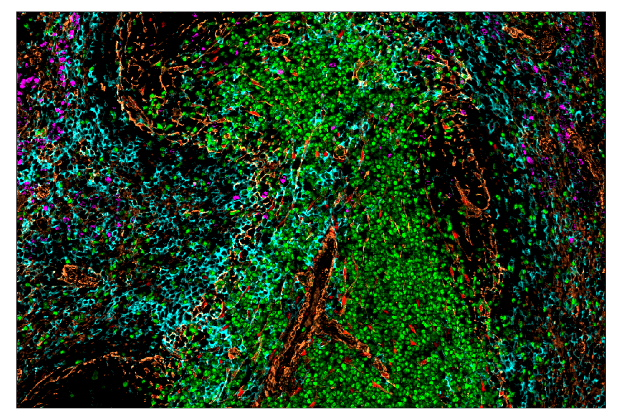 Immunohistochemistry Image 7: Ki-67 (D3B5) & CO-0052-750 SignalStar™ Oligo-Antibody Pair