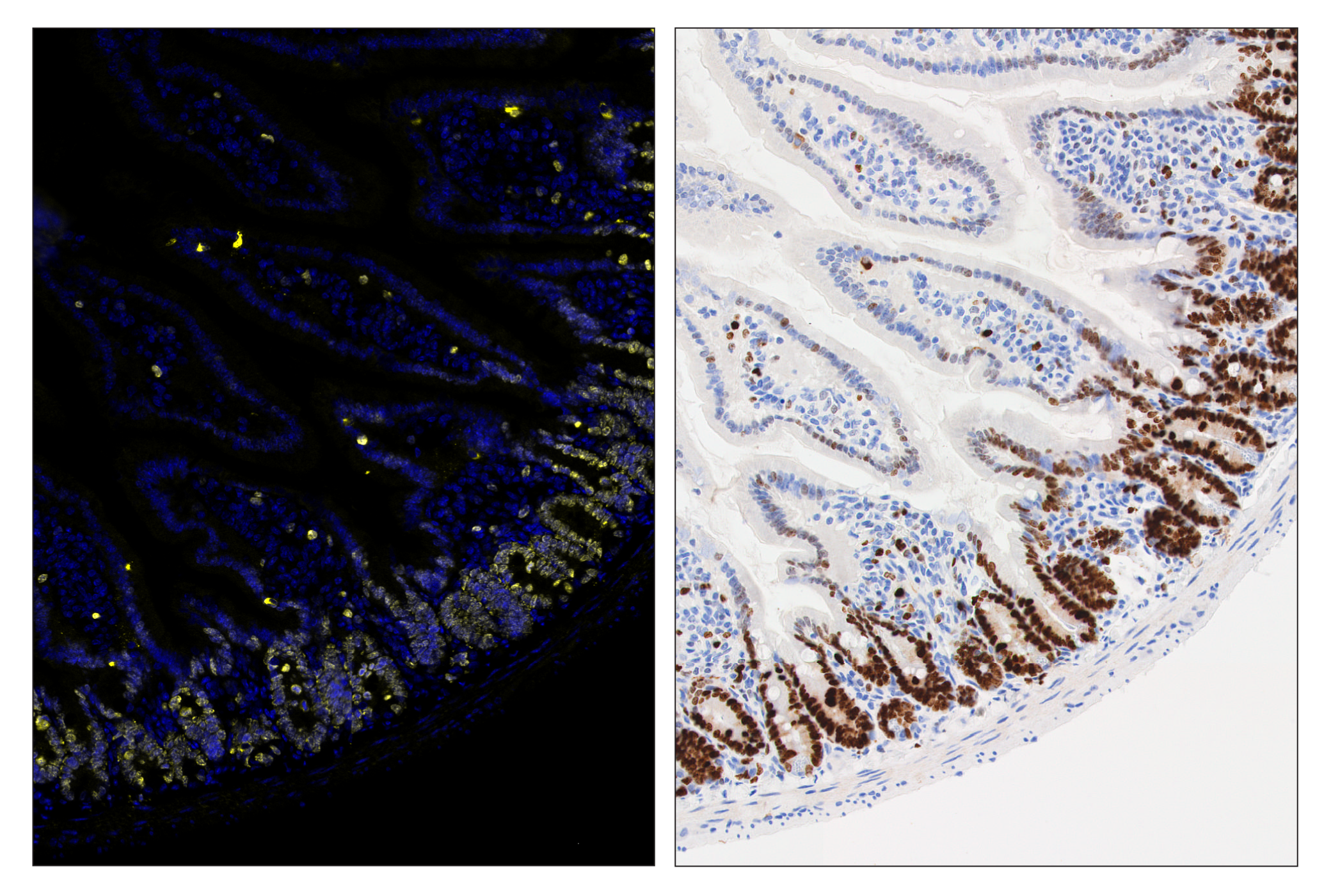 Immunohistochemistry Image 6: Ki-67 (D3B5) & CO-0052-750 SignalStar™ Oligo-Antibody Pair