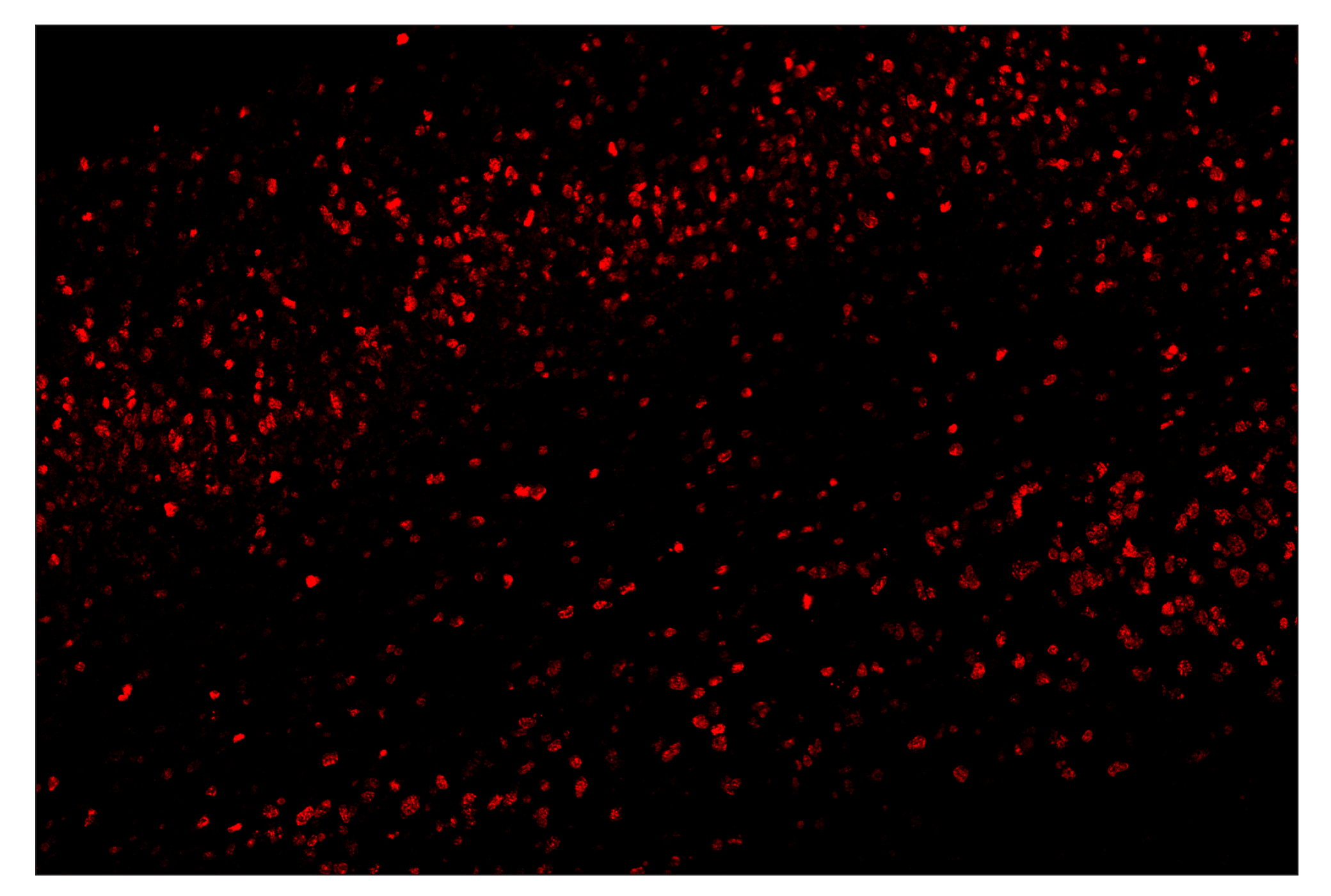 Immunohistochemistry Image 4: Ki-67 (D3B5) & CO-0052-594 SignalStar™ Oligo-Antibody Pair