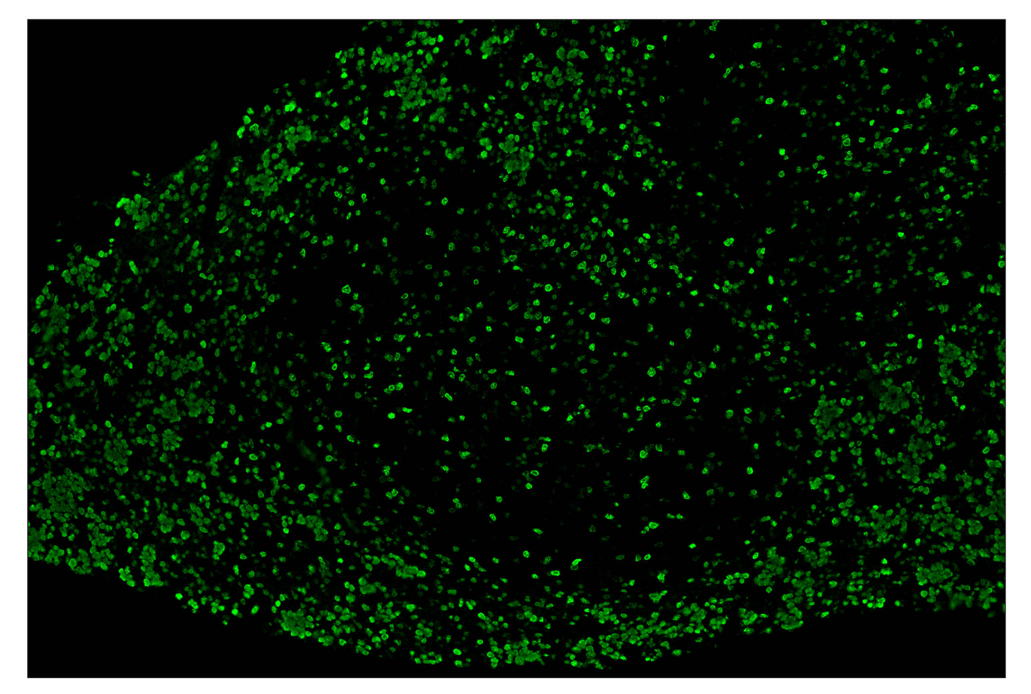 Immunohistochemistry Image 2: Ki-67 (D3B5) & CO-0052-647 SignalStar™ Oligo-Antibody Pair
