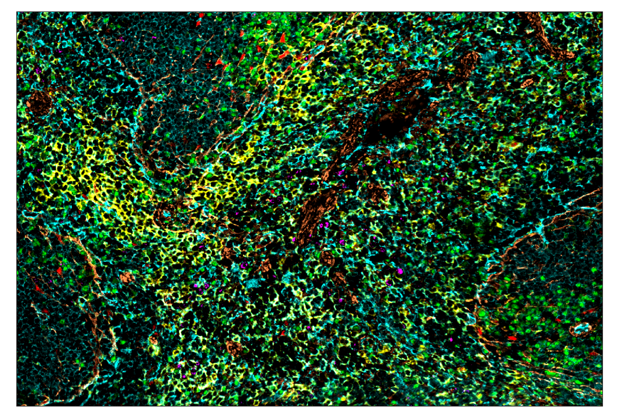 Immunohistochemistry Image 1: Ki-67 (D3B5) & CO-0052-488 SignalStar™ Oligo-Antibody Pair