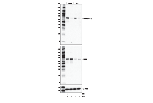 Western Blotting Image 1: Phospho-BLNK (Thr152) Antibody