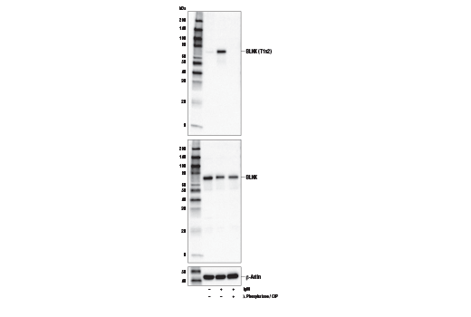 Western Blotting Image 2: Phospho-BLNK (Thr152) Antibody