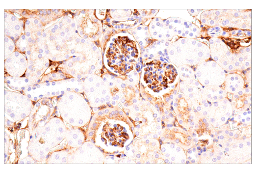  Image 19: Late-Onset Alzheimer's Disease Risk Gene (Mouse Model) Antibody Sampler Kit