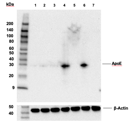  Image 33: Late-Onset Alzheimer's Disease Risk Gene (Mouse Model) Antibody Sampler Kit