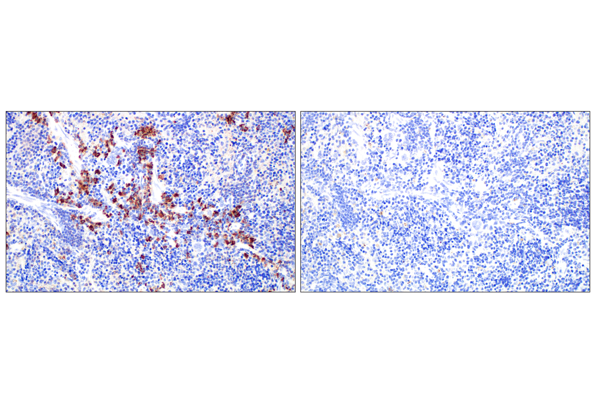 Immunohistochemistry Image 7: IgM (E8M1B) XP® Rabbit mAb (BSA and Azide Free)
