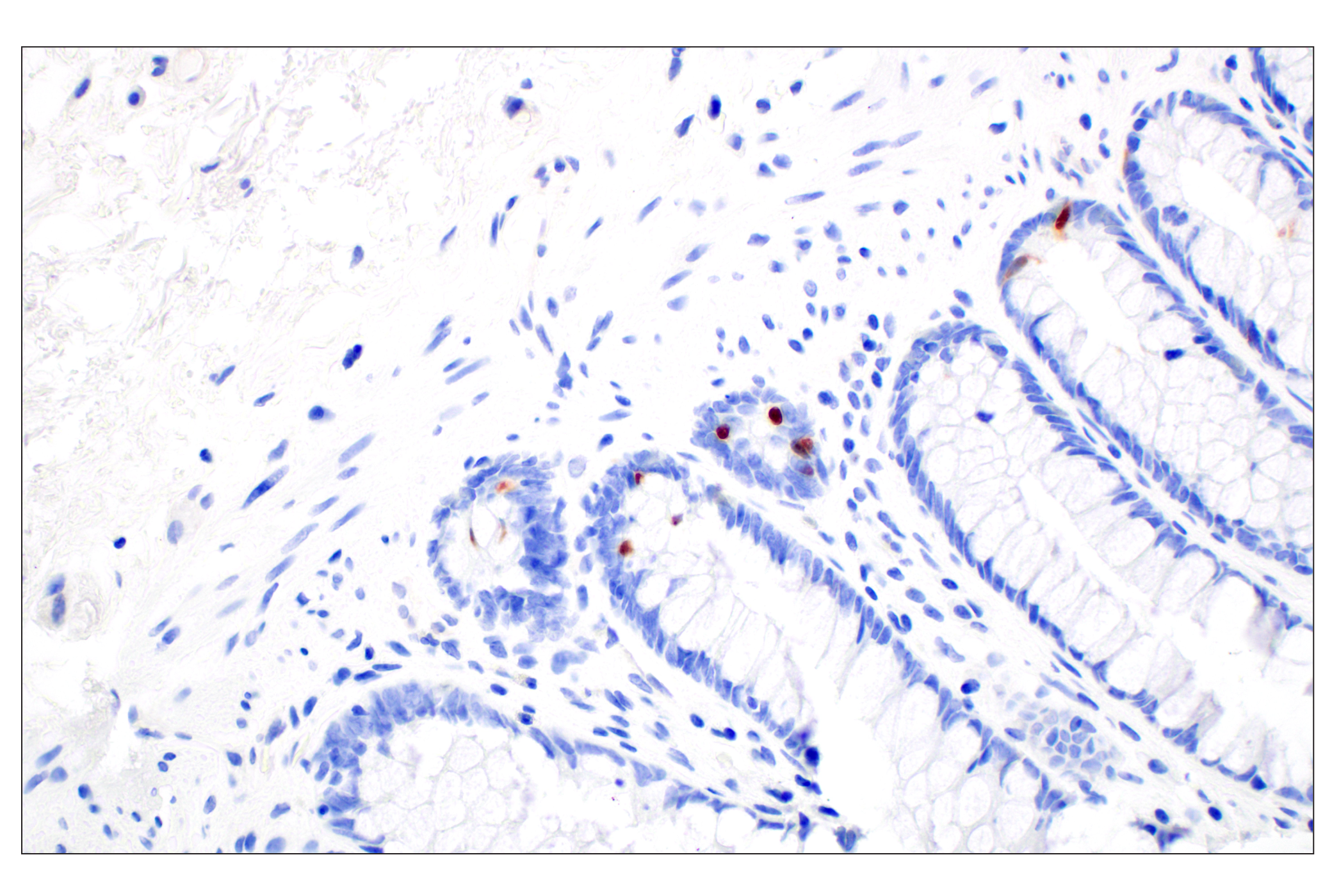 Immunohistochemistry Image 2: OCA-T1 (E4T1K) Rabbit mAb