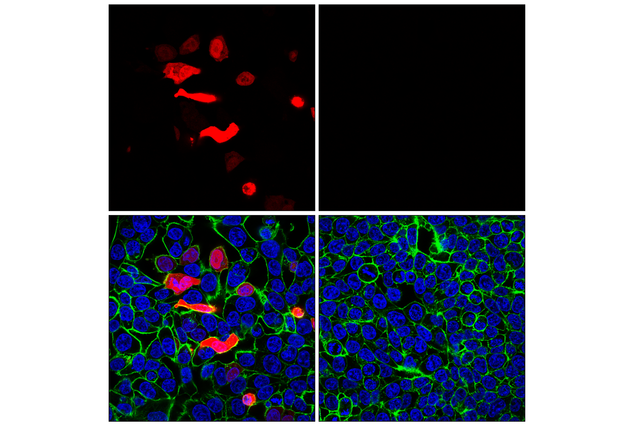 Immunofluorescence Image 1: V5-Tag (D3H8Q) Rabbit mAb (Alexa Fluor® 555 Conjugate)