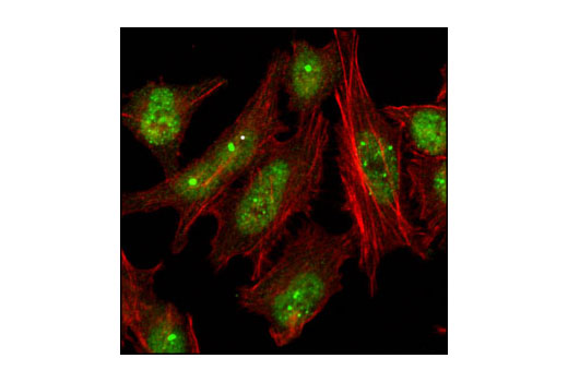 Immunofluorescence Image 1: 53BP1 Antibody