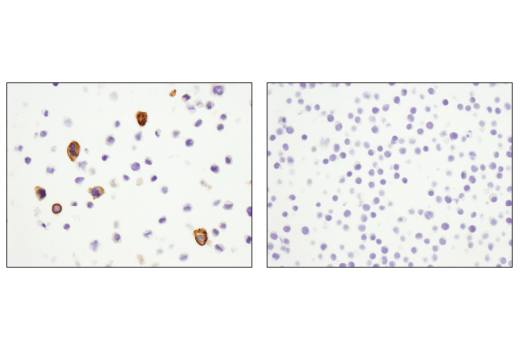  Image 49: Suppressive Myeloid Cell Phenotyping IHC Antibody Sampler Kit