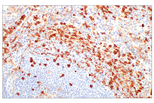  Image 40: Suppressive Myeloid Cell Phenotyping IHC Antibody Sampler Kit