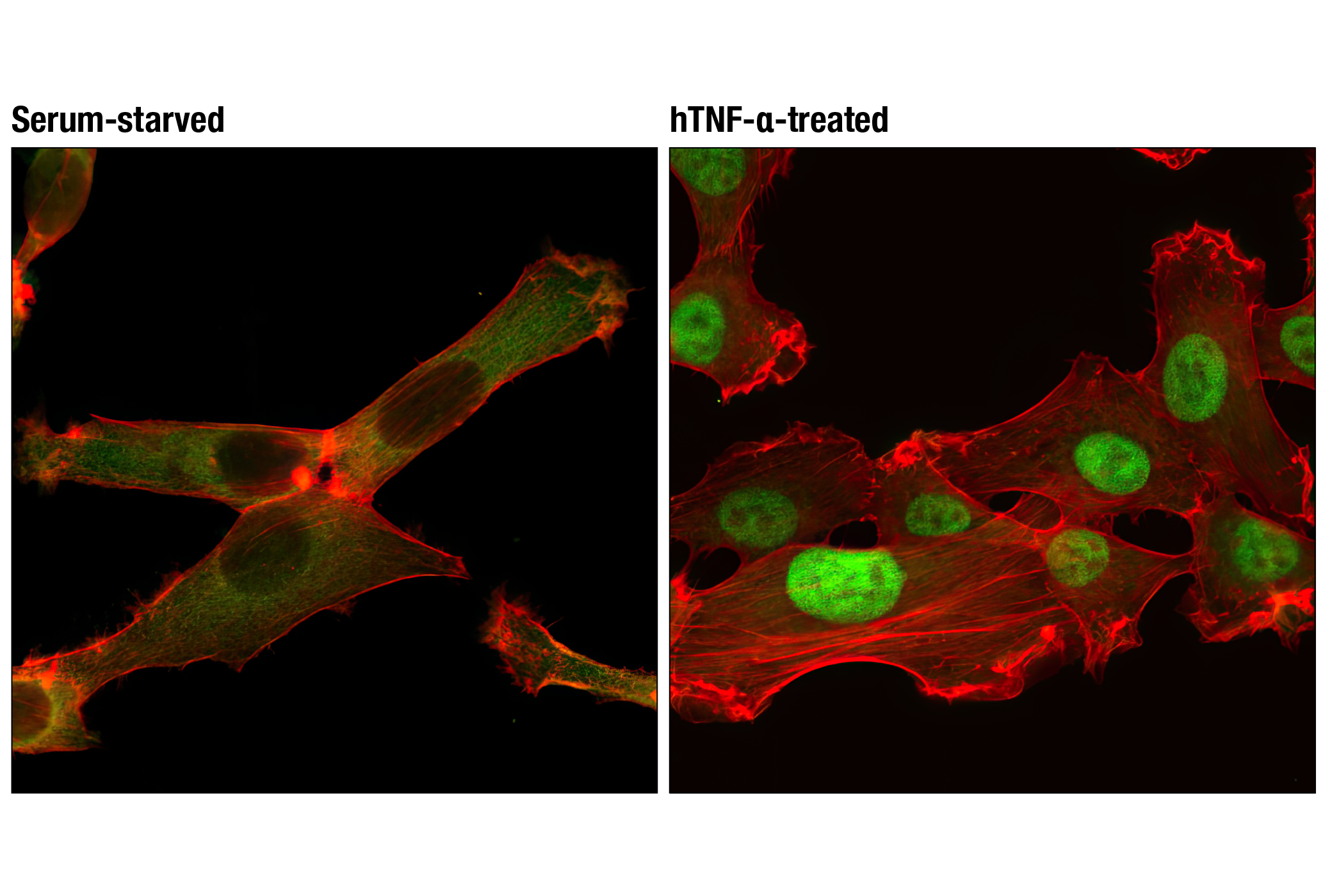 Immunofluorescence Image 1: NF-κB p65 (D14E12) XP® Rabbit mAb (Alexa Fluor® 488 Conjugate)