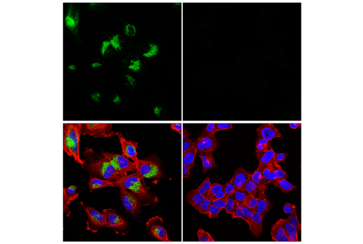 Immunofluorescence Image 1: PAI-1 (E3I5H) XP® Rabbit mAb