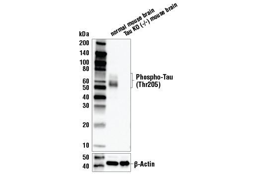  Image 8: Tau Mouse Model Neuronal Viability IF Antibody Sampler Kit