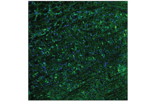  Image 50: Tau Mouse Model Neuronal Viability IF Antibody Sampler Kit