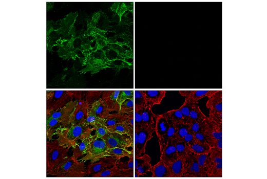 Immunofluorescence Image 1: Claudin-5 (E8F3D) Rabbit mAb
