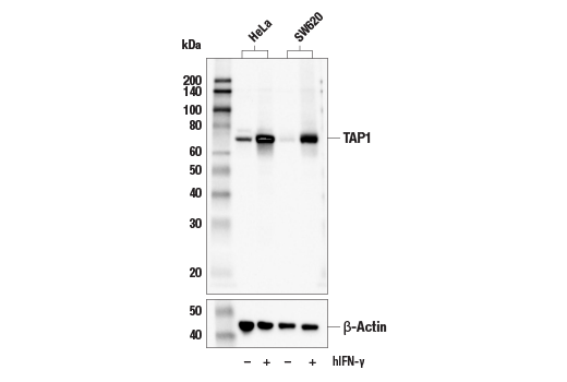  Image 9: MHC Class I Antigen Processing and Presentation Antibody Sampler Kit